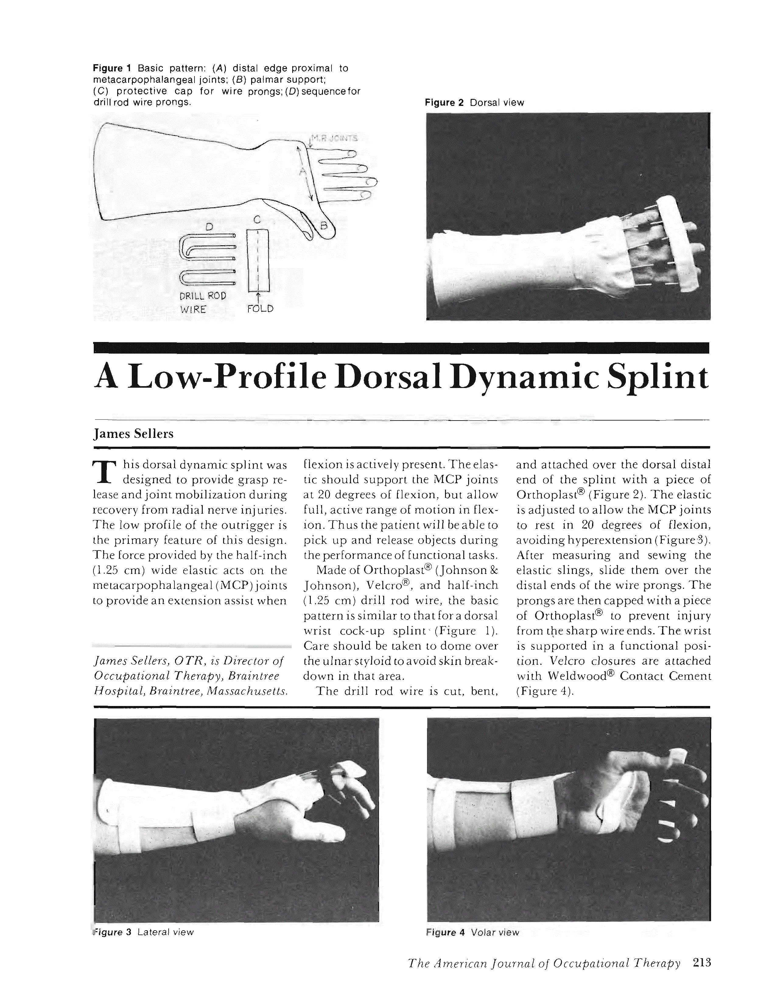 A Low-Profile Dorsal Dynamic Splint | The American Journal of ...